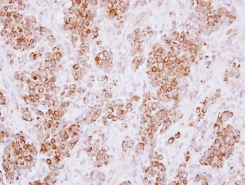 HLA-DMA Rabbit Polyclonal Antibody