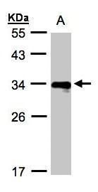 HLA-DR beta antibody [N1C3]