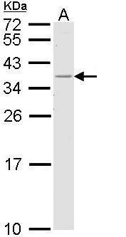 HLA-DR antibody [N2C3]