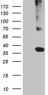 HLA-DRB5 Antibody