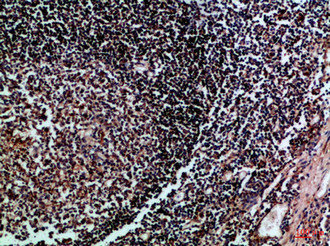 HLA-DMB Antibody