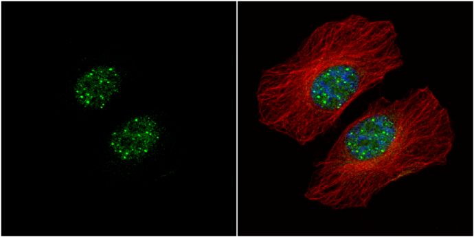 HMBOX1 Rabbit Polyclonal Antibody