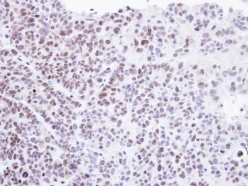 HMBOX1 Rabbit Polyclonal Antibody