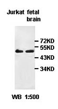 HMG20A Rabbit Polyclonal Antibody