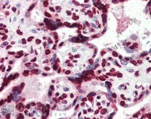 HMGA1 Antibody