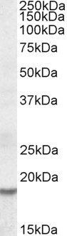 HMGI-C/HMGA2 Antibody