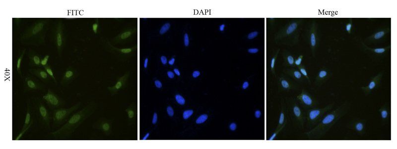 HMGB1 Rabbit Polyclonal Antibody (FITC)