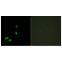 HMGN2 Antibody