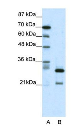 HMOX2 Rabbit Polyclonal Antibody