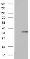HNF1-Beta(HNF1B) Antibody