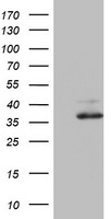 HNF1-Beta(HNF1B) Antibody