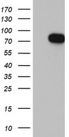 HNF1-Beta(HNF1B) Antibody