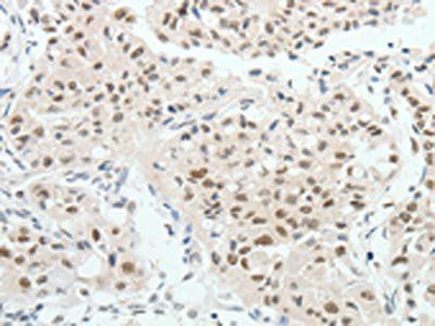 HNF1B Antibody