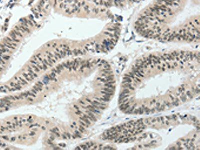 HNF1B Antibody