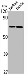 HNF1B Antibody