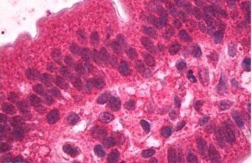 HNF4A Antibody