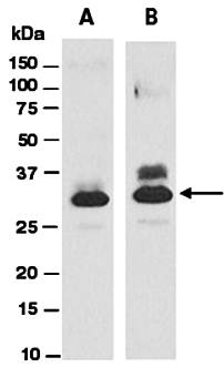 HNMT (vPairTM) Antibodies