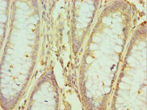 HNRNPM Antibody