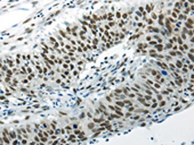 HNRNPM Antibody