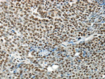 HNRNPM Antibody