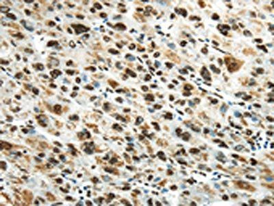 HNRNPM Antibody