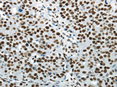 HNRNPM Antibody