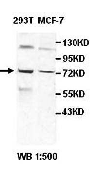 HNRNPM Rabbit Polyclonal Antibody