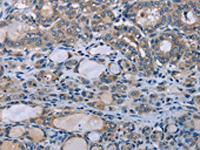 HOMER1 Antibody