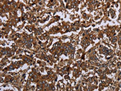 HOMER2 Antibody