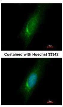 Homer3 Rabbit Polyclonal Antibody