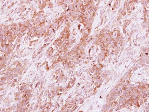 Homer3 Rabbit Polyclonal Antibody