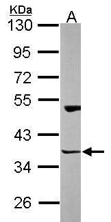Homer3 Rabbit Polyclonal Antibody