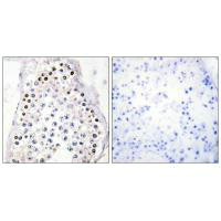 HOXB1/HOXA1/HOXD1 Antibody