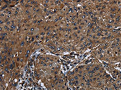 HOXC8 Antibody