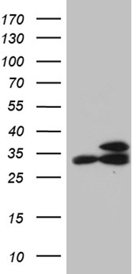 HOXD8 Antibody