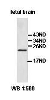 HPCAL4 Rabbit Polyclonal Antibody
