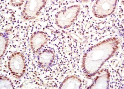 HPV33 E6 Rabbit Polyclonal Antibody