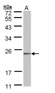 DUSP3 Rabbit Polyclonal Antibody