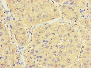 RIDA Antibody