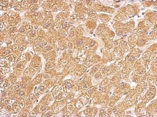 hydroxysteroid 11-beta dehydrogenase 1 Antibody