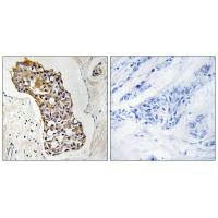 HSD11B1 Antibody