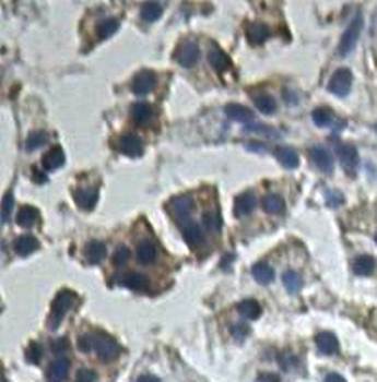 HSD17B11 Rabbit Polyclonal Antibody