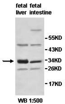 HSD17B11 Rabbit Polyclonal Antibody