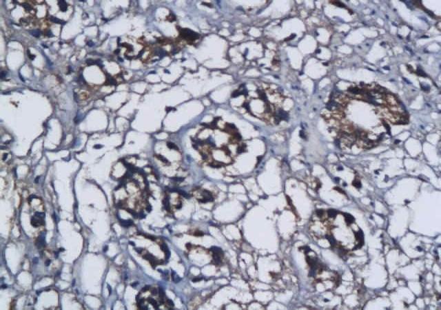 HSD17B2 Rabbit Polyclonal Antibody