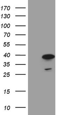 SETD1A Antibody