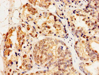 HSF2 Antibody