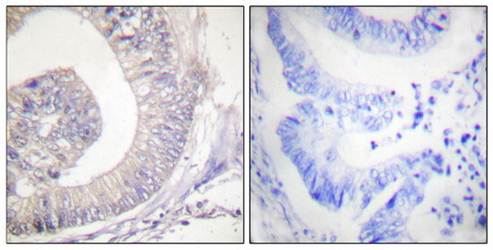 HSL (Phospho-Ser855/554) Antibody