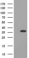 HSPB8 Antibody