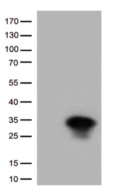 HSPB1 Antibody