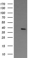 DNAJB1 Antibody